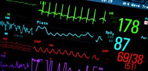 simbolika ekg nalaza